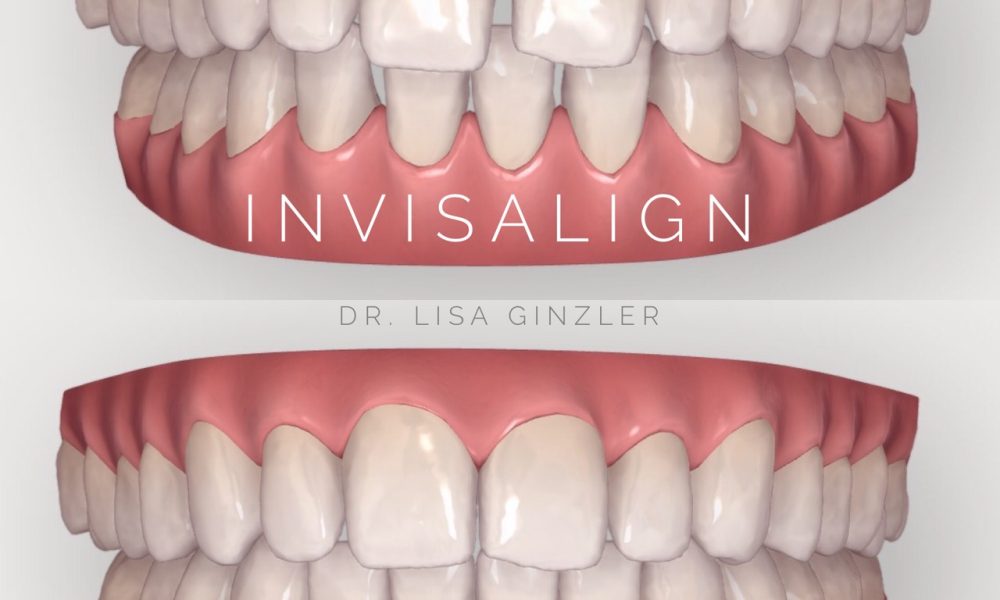 LG Dental Studio, Dr. Lisa Ginzler