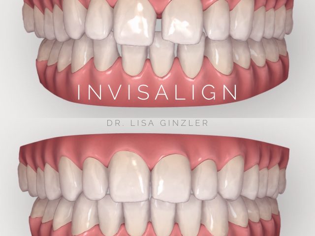 LG Dental Studio, Dr. Lisa Ginzler