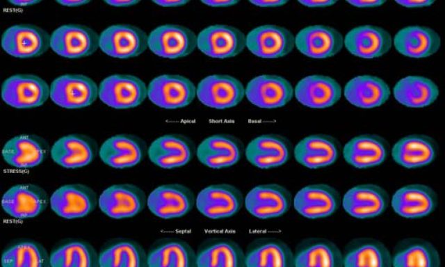 Simplified Imaging Solutions