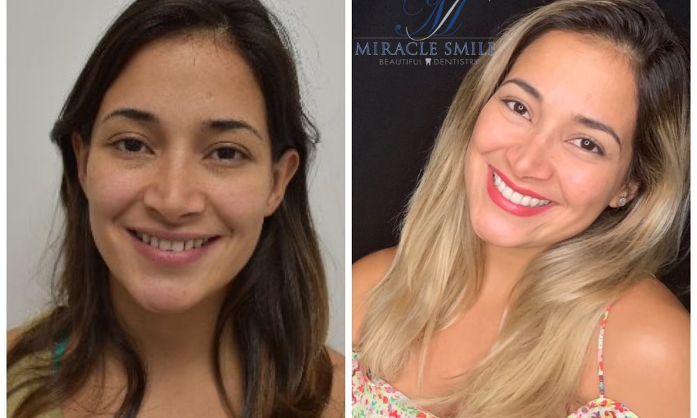 Miracle Smile Dentistry Dr. Anna Aller and Dr. Howell Goldberg