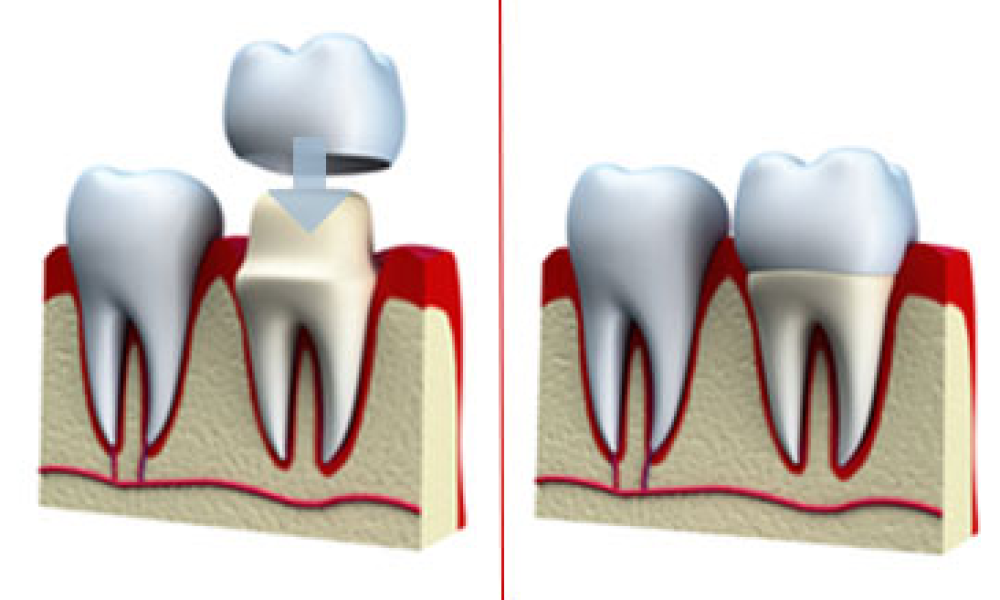 Preferred Dental Care
