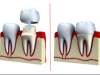 Preferred Dental Care